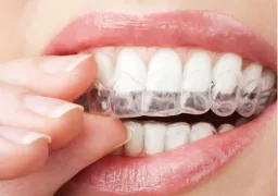 白金台の歯医者・矯正歯科「カズデンタルクリニック白金台」|矯正歯科